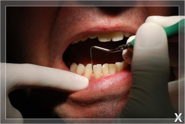 Многие боятся зубных врачей
