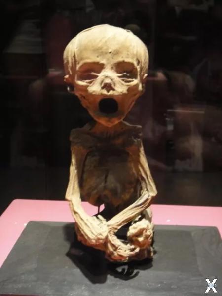 Зародыш самой маленькой мумии в мире ...