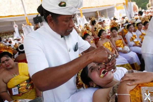 Церемония подпиливания зубов на Бали