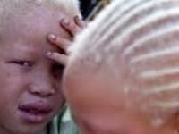 Сафари на альбиносов