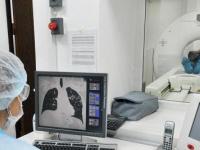 Компьютерная томография легких: преимущества метода, особенности проведения