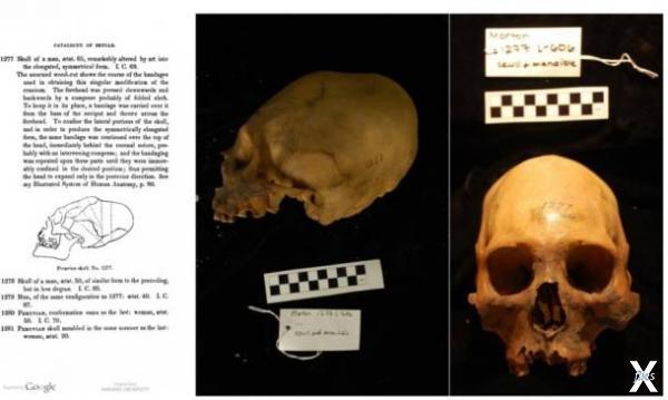 Коллекция Мортона, череп № 1277, Музе...