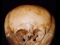 Доказательство посещения Земли инопланетянами 900 лет назад - "череп Звездного ребенка"