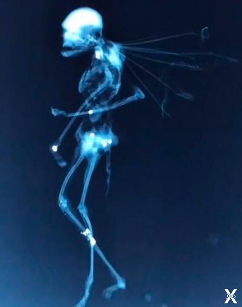 Рентгеновский снимок мумии феи