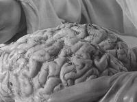 Мозг Ленина: чему удивились патологоанатомы