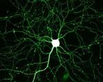 Ученые раскрыли механизм образования нервных клеток