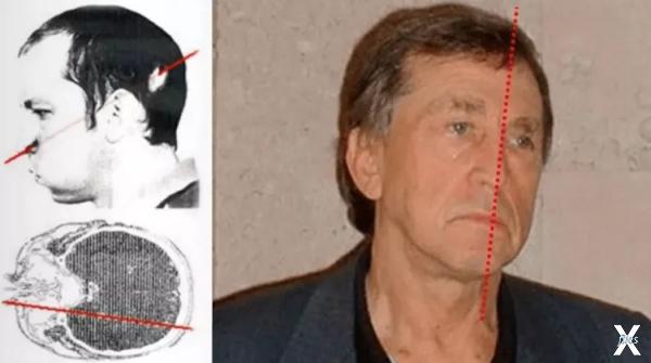 Анатолий не чувствовал боли, поэтому ...