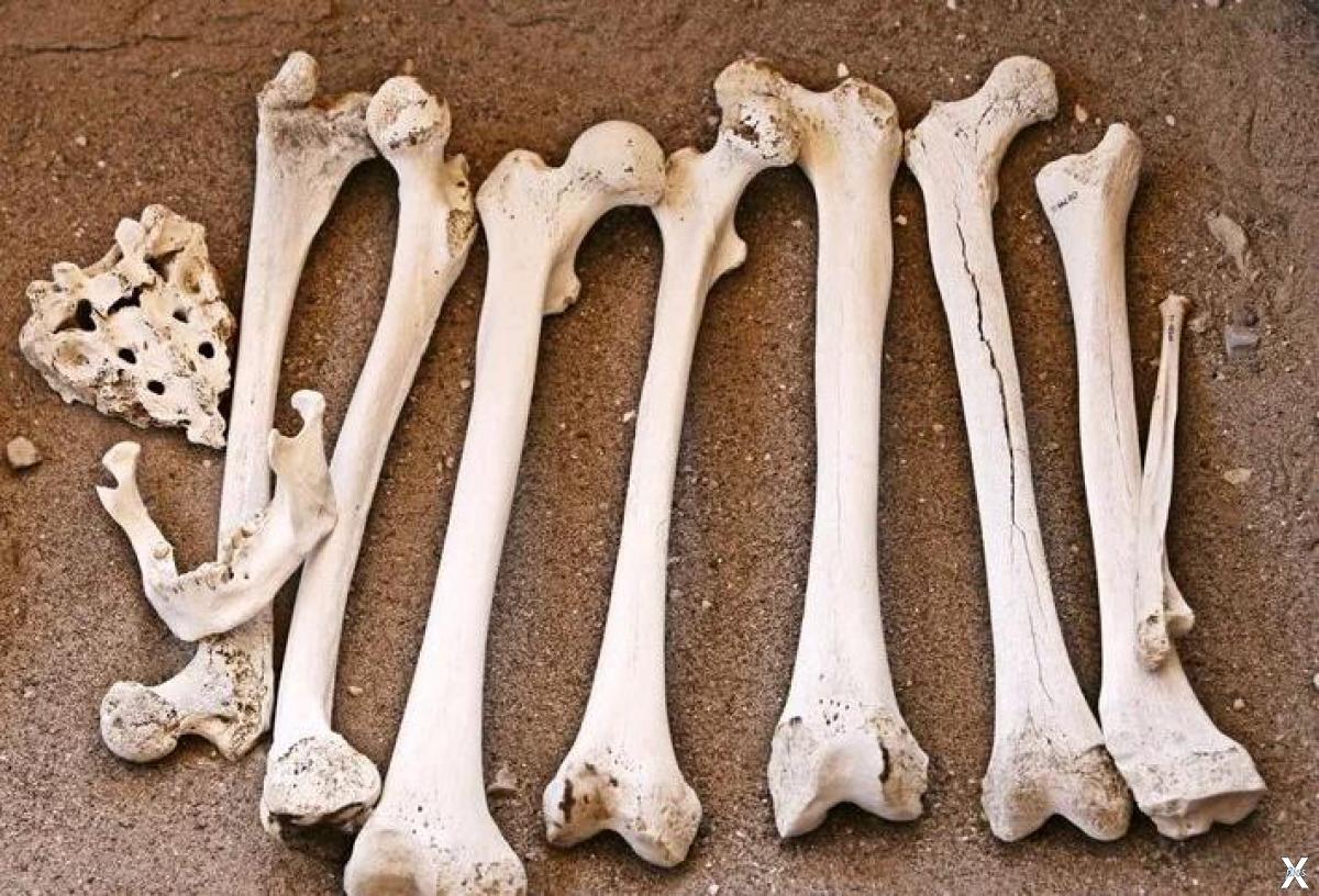 Elder bone. Кости человека. Куча человеческих костей.