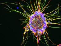 Найден способ получения нервных клеток из клеток кожи
