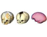 Описаны отличия между мозгом человека разумного и неандертальца