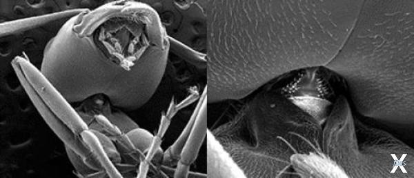 Компьютерная микротомография шеи мура...