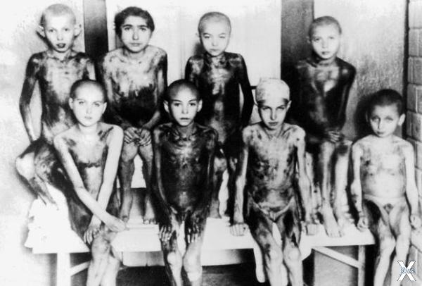 Дети — жертвы нацистских медицинских ...
