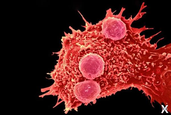Иммунные клетки атакуют раковую опухоль