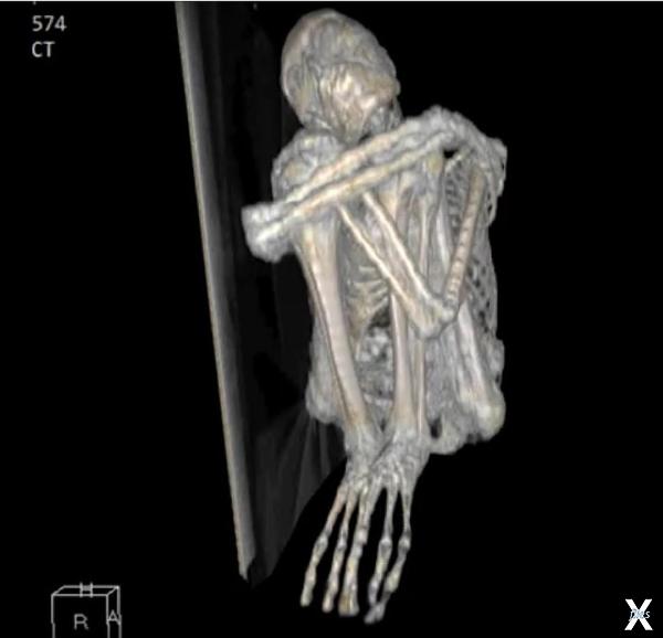 Изображении мумии Марии в томографе