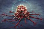 Сенсация: ученые создали вирус, который убивает любые раковые клетки