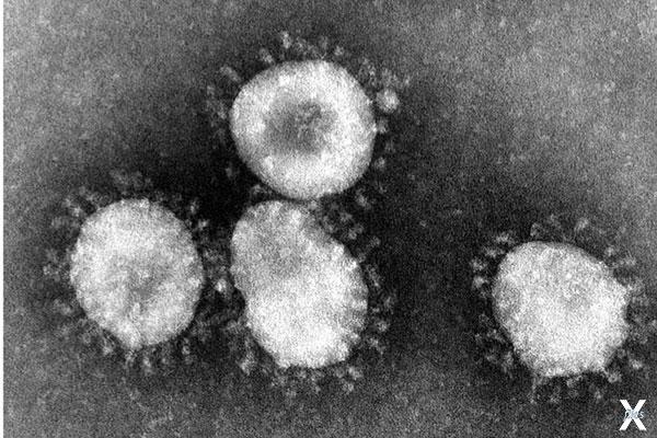 Так выглядят коронавирусы, напавшие н...