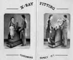 «Чудо-изобретения» для обувных магазинов 1920-50-х гг и к каким последствиям для здоровья приводило их использование