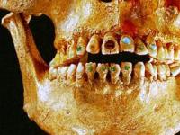 Древние люди украшали зубы драгоценными камнями
