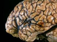 Рост и размер мозга современного человека уменьшаются