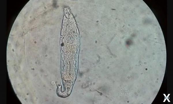 Коловратка под микроскопом