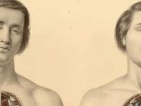 Новые органы и части человеческого тела, которые недавно обнаружили учёные